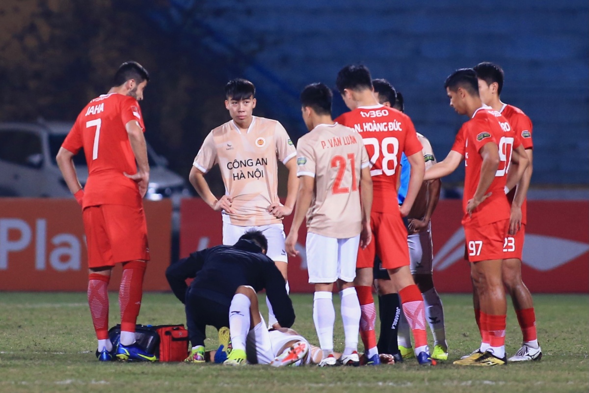 Bùi Hoàng Việt Anh nhập viện khẩn cấp, HLV Troussier ngồi trên đống l 1