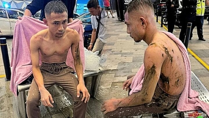 Ngôi sao Malaysia đối mặt nguy cơ giải nghệ sớm vì bị tạt axit 1