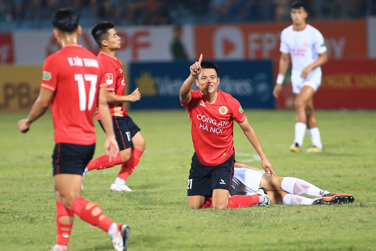 Hoàng Đức dính chấn thương trước thềm ĐT Việt Nam hội quân 2 Hoàng Đức dính chấn thương trước thềm ĐT Việt Nam hội quân 2