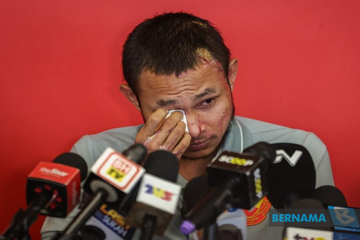 Faisal Halim sau sự cố bị tạt axit Faisal Halim sau su co bi tat axit