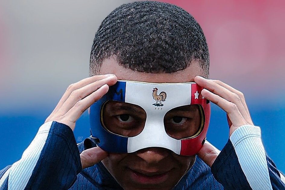 Mbappe lộ mặt nạ 2