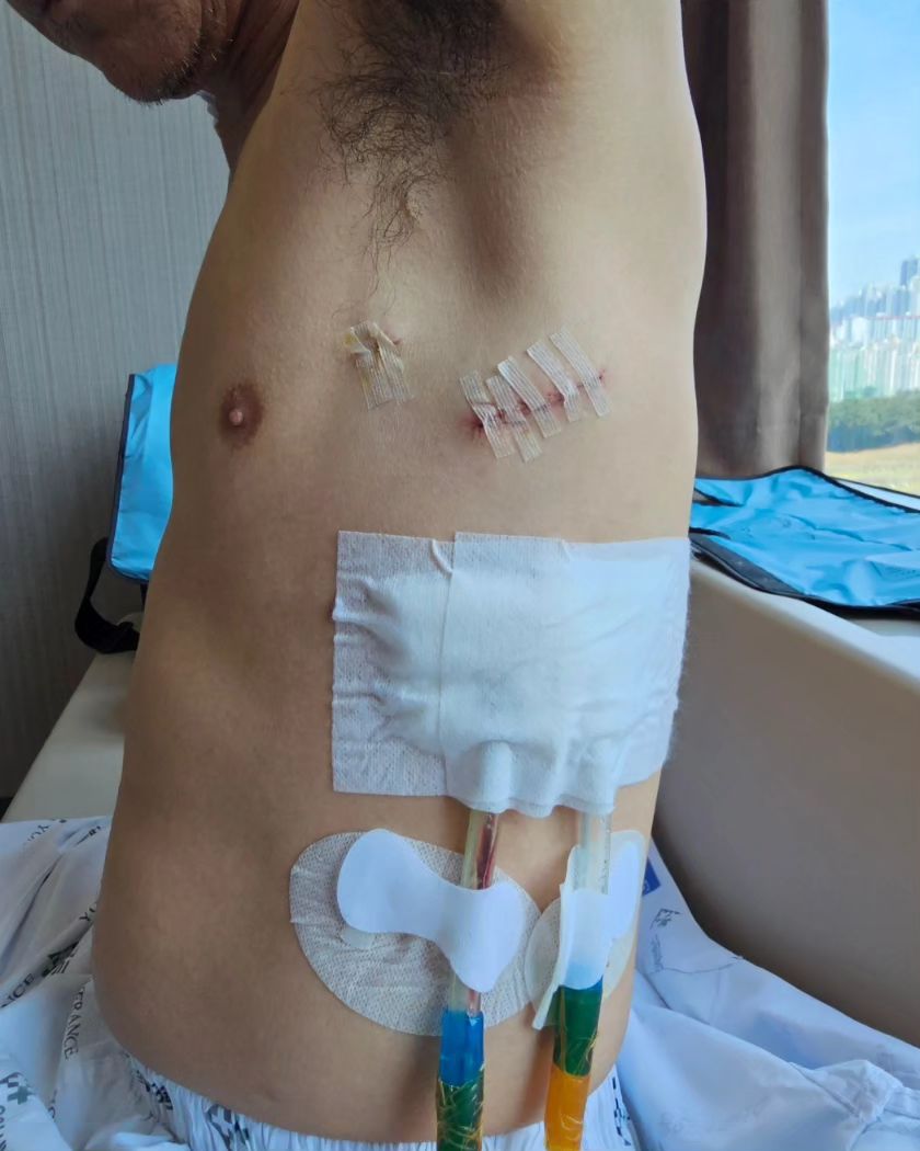 HLV Shin Tae Yong yêu cầu được xuất viện sớm để phục vụ ĐT Indonesia 2