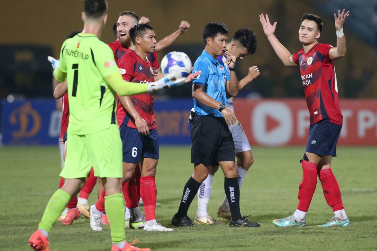 HLV Mano Polking bức xúc khi nhận bàn thua phút bù giờ thứ 14 1 HLV Mano Polking bức xúc khi nhận bàn thua phút bù giờ thứ 14 1