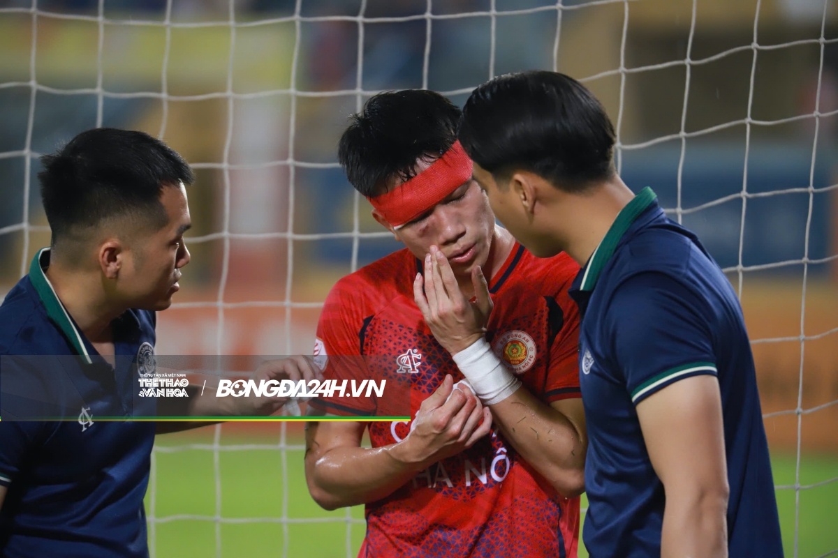 Cơn đau đầu của HLV Mano Polking 4