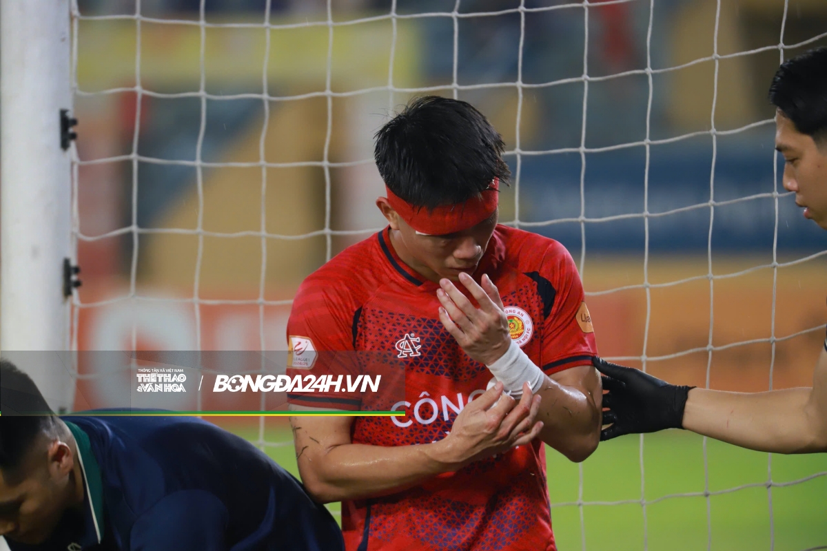 Cơn đau đầu của HLV Mano Polking 3