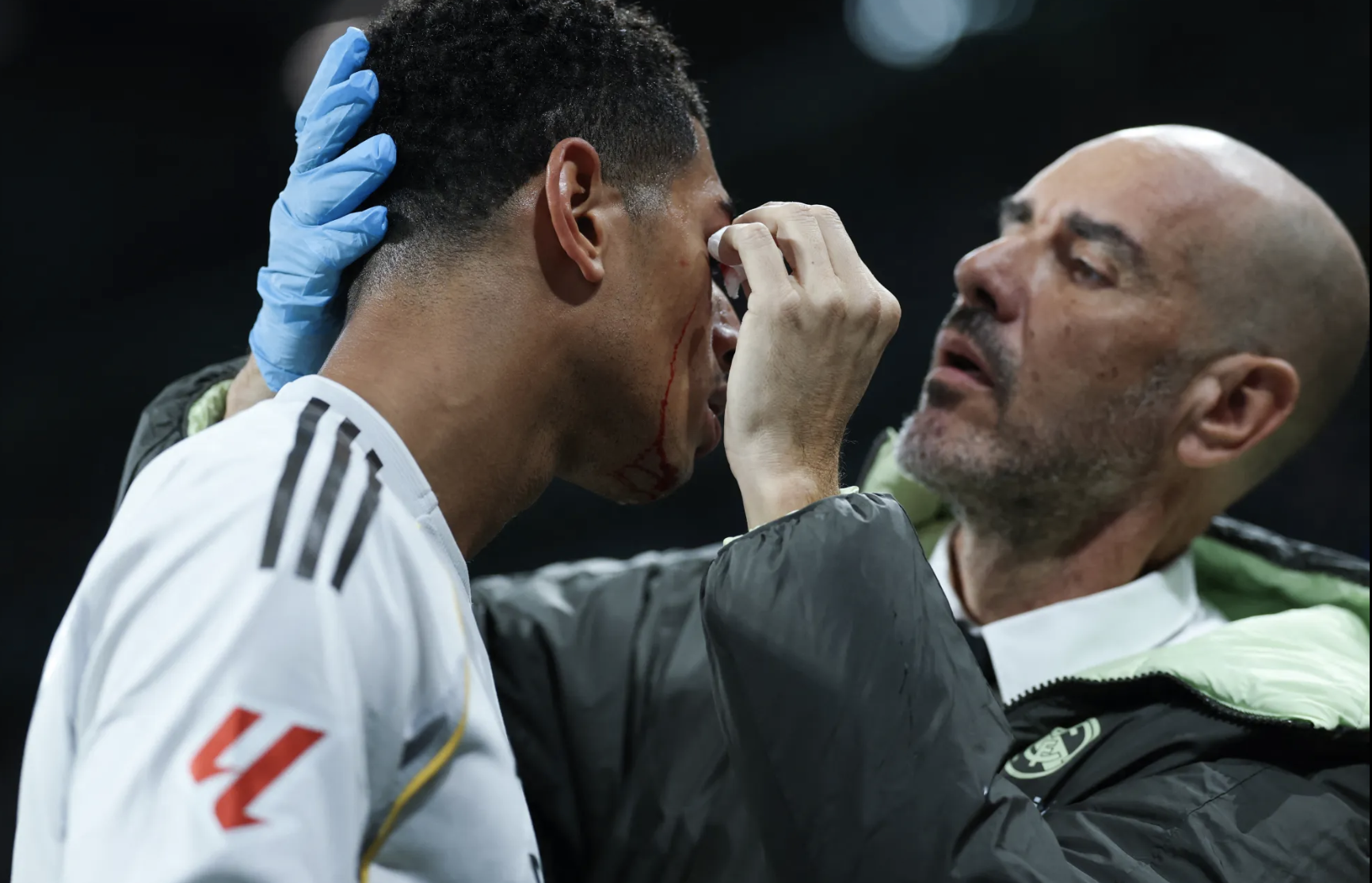 Jude Bellingham đổ máu trong tráşn Real Madrid thua thảm