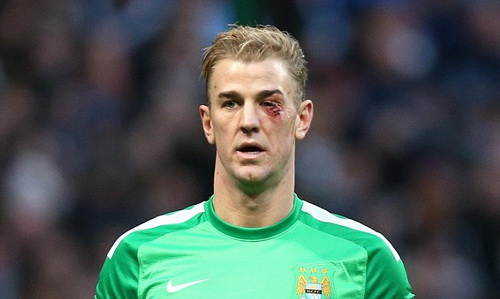 Người hùng thầm lặng của Man City: Can trường như Joe Hart