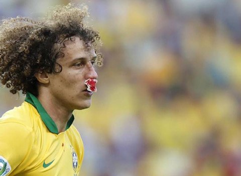 Sao Chelsea bị vỡ mũi tại Confed Cup