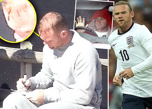 Anh - Moldova, còn 1 ngày: Roy Hodgson giữa cơn bão chấn thương