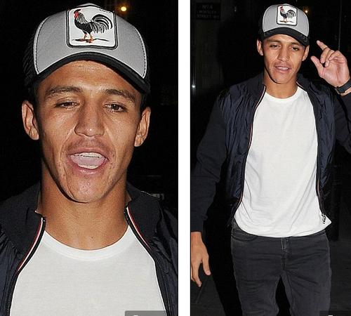 Alexis Sanchez thác loạn sau khi lập đại công cho Arsenal