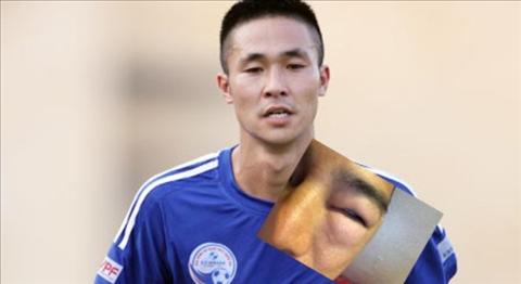 Đồng đội Mạc Hồng Quân đấm người trên sân phủi