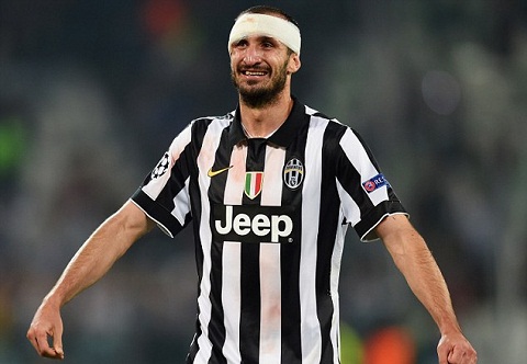 Juventus gap khi Giorgio Chiellini dinh chan thuong  hinh anh