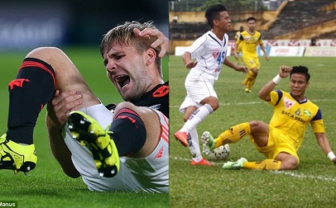 Từ Ngọc Hải đến Moreno: 2 mặt của 1 vấn đề!