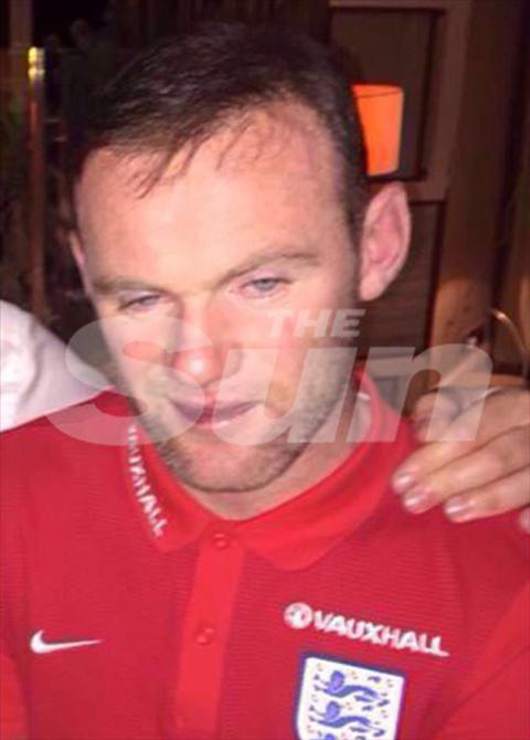 Wayne Rooney say mem khi duong thuong hinh anh