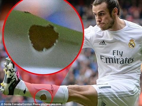 Gareth Bale di tat rach trong tran gap Celta Vigo hinh anh