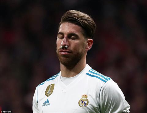 Trung vệ Sergio Ramos vỡ mũi sau trận derby Madrid