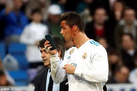 Cristiano Ronaldo muon dien thoai cua bac si de tu kiem tra vet thuong.