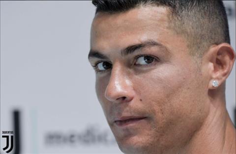 Khuon mat rang ro cua Ronaldo trong buoi kiem tra y te tai Juventus.