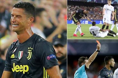 HLV Juventus nói gì khi Ronaldo được tham dự trận đấu với MU?