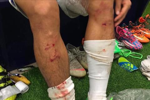 Rợn người chấn thương của Văn Kiên sau pha vào bóng của Quế Ngọc Hải