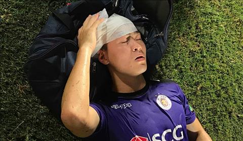 Duy Mạnh chấn thương: Cơ hội sẽ dành cho ai?