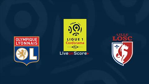 Lyon vs Lille 3h10 ngày 221 Cúp Liên đoàn Pháp hình ảnh