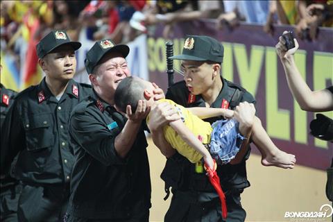 CĐV nhí bị ngất trận Nam Định vs HAGL: CSCĐ kịp thời cấp cứu tránh nuốt lưỡi