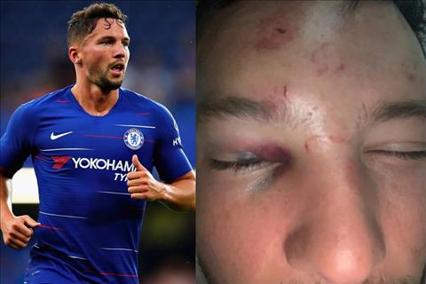 Tiền vệ Danny Drinkwater bị đánh vì thói dại dột  hình ảnh