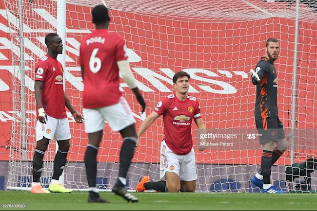 3 phương án để MU đối phó với Newcastle