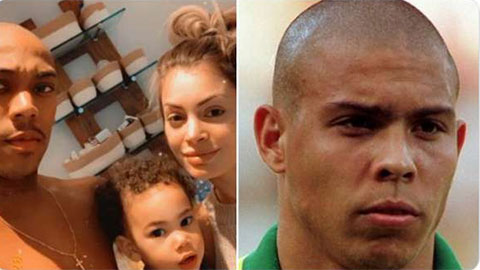 Rảnh rỗi sinh nông nổi, sao MU ngứa tay… cạo đầu trọc lốc