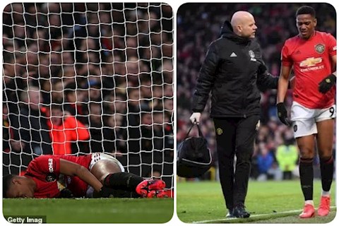 Martial khoe đầu gối đẫm máu sau trận thắng Man City