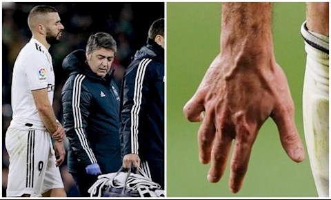 Thua sốc Real Betis, Real Madrid còn nhận tin buồn từ trụ cột