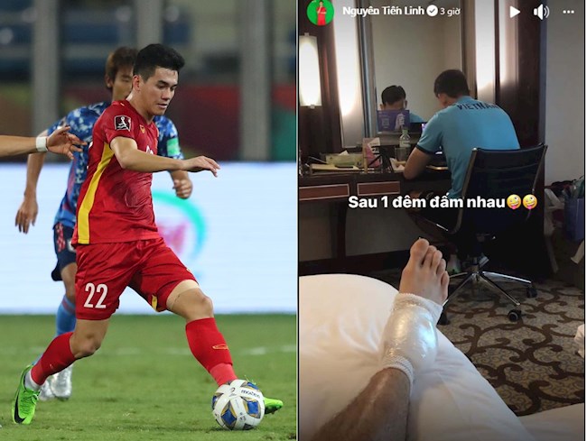 Tiến Linh phải chườm đá cổ chân sau trận gặp Nhật Bản