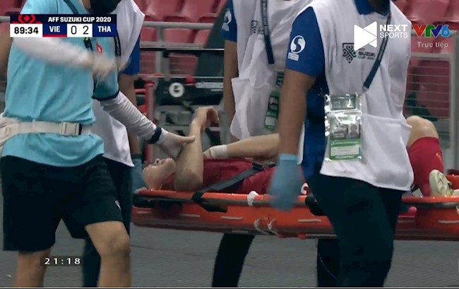 Duy Mạnh dính chấn thương Duy Mạnh dính chấn thương