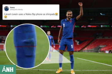Dominic Calvert-Lewin gây bất ngờ với miếng đệm ống chân kỳ lạ
