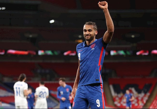 Calvert-Lewin lập công từ kỹ năng đánh đầu sở trường