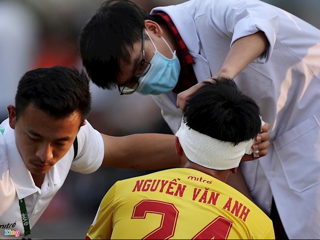 Chú họ Văn Toàn gãy xương gò má khi thi đấu ở giải Hạng Nhất hình ảnh Chú họ Văn Toàn gãy xương gò má khi thi đấu ở giải Hạng Nhất hình ảnh