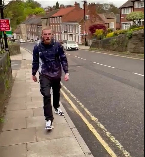 Oli McBurnie bị bắt sau khi tấn công NHM Oli McBurnie bị bắt sau khi tấn công NHM