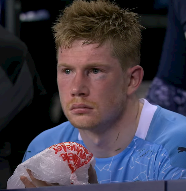 De Bruyne phẫu thuật thành công vùng mặt trước thềm Euro 2020 hình ảnh