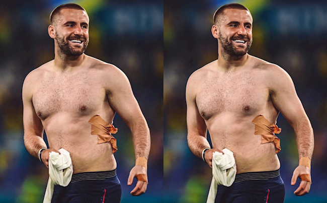 Luke Shaw tự tin bình phục trước mùa giải