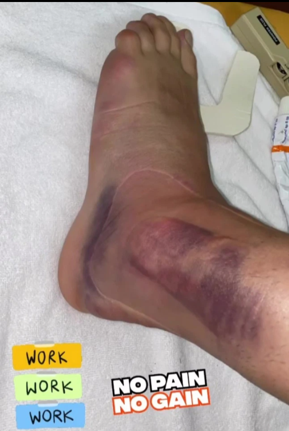 Dani Ceballos gặp vấn đề nghiêm trọng Dani Ceballos gặp vấn đề nghiêm trọng