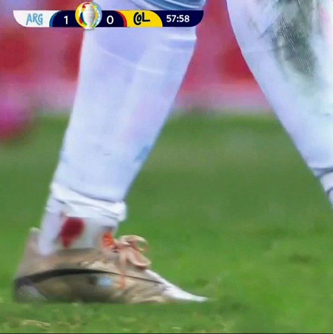 Messi ở trận đấu với Colombia