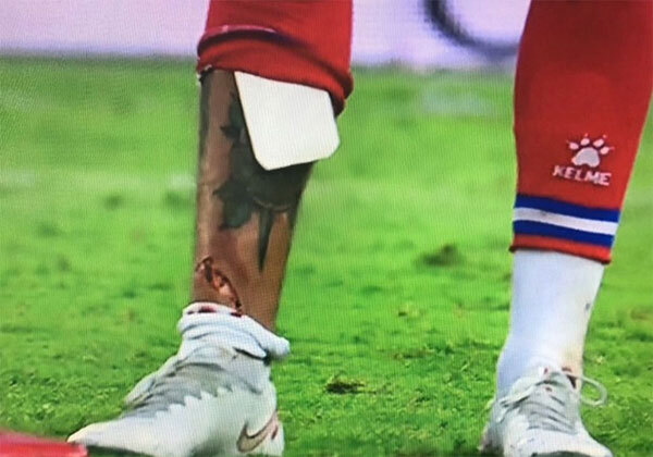 Tiền vệ Aleix Vidal đã dính chấn thương kinh hoàng trong trận hòa 2-2 giữa Espanyol và Real Betis, nhiều người không dám nhìn vết rách ở chân của cầu thủ này. Tiền vệ Aleix Vidal đã dính chấn thương kinh hoàng trong trận hòa 2-2 giữa Espanyol và Real Betis, nhiều người không dám nhìn vết rách ở chân của cầu thủ này.