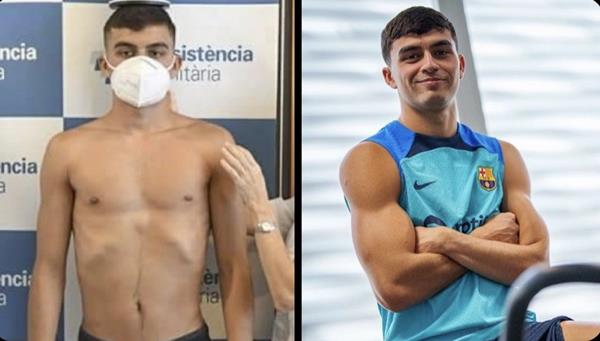 Pedri thay doi dang ke ve mat the hinh