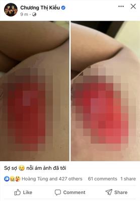 Xót xa hình ảnh chấn thương của trung vệ thép ĐT Việt Nam 1 Xót xa hình ảnh chấn thương của trung vệ thép ĐT Việt Nam 1