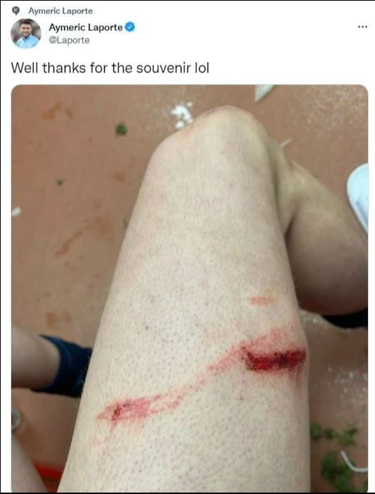 Laporte có một vết rách ở đùi Laporte có một vết rách ở đùi