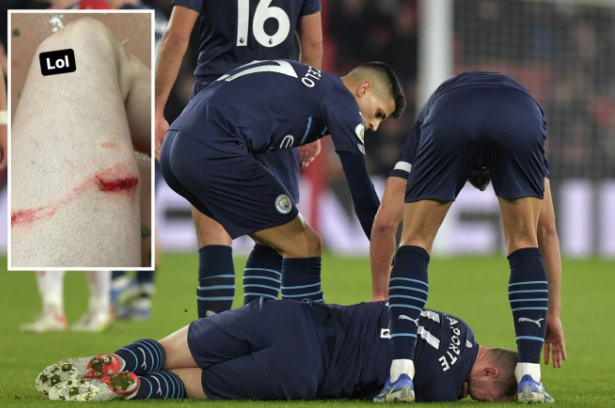 Aymeric Laporte rách đùi sau trận hòa Southampton