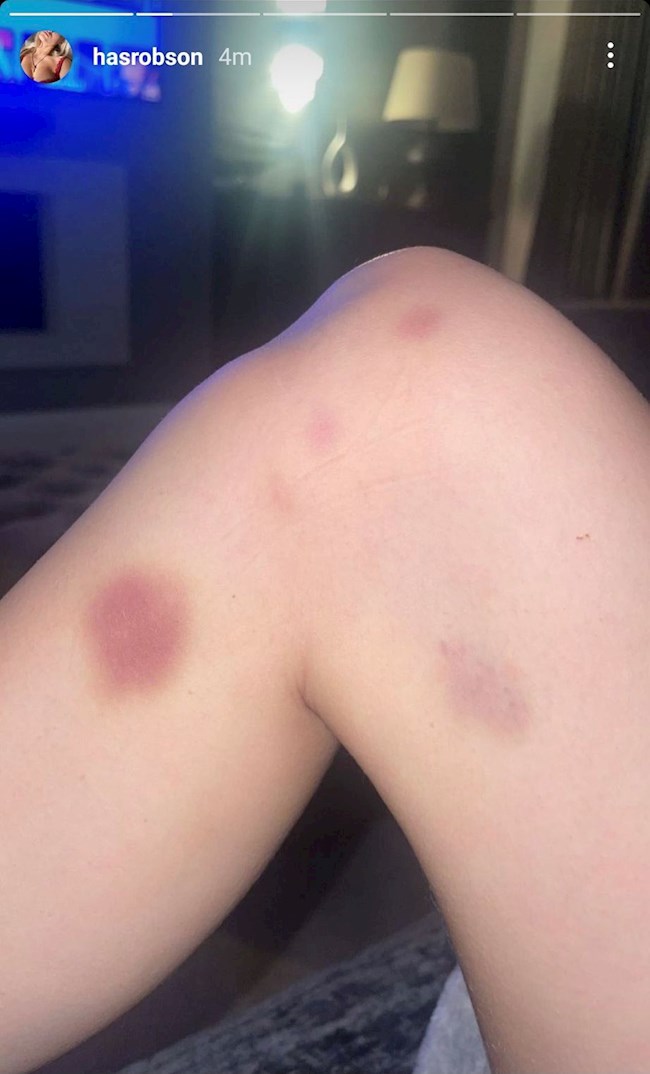 Harriet Robson Harriet Robson