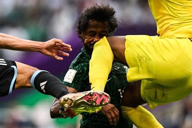 Hậu vệ Saudi Arabia dính chấn thương kinh hoàng, sớm chia tay World Cup 2022