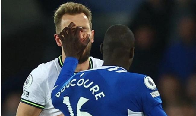 HLV Everton bất ngờ tấn công Harry Kane